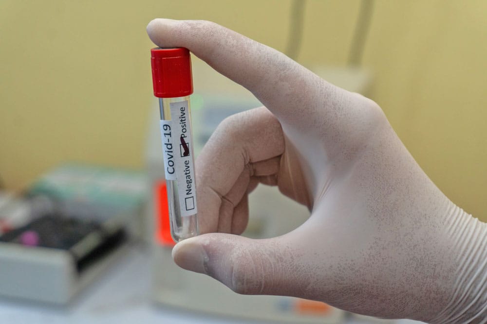 Delta variant a ‘big problem’ in WDGPH region: Tenenbaum